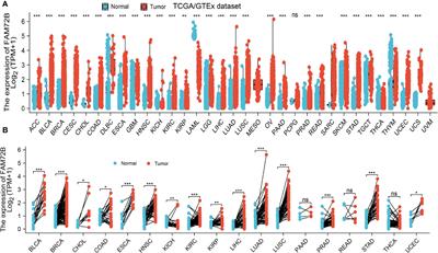 Identifying Immune Cell Infiltration and Effective Diagnostic Biomarkers in Lung Adenocarcinoma by Comprehensive Bioinformatics Analysis and In Vitro Study
